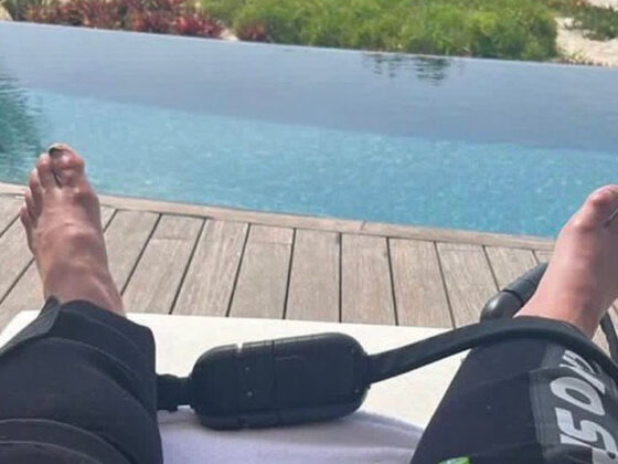 Impactante imagen de los pies de Cristiano Ronaldo enciende las redes Impactante imagen de los pies de Cristiano Ronaldo enciende las redes