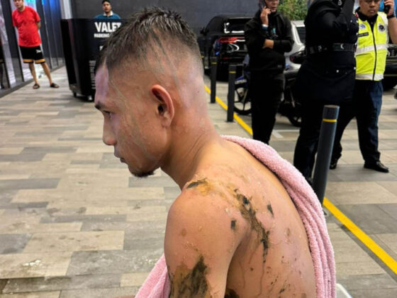 Seleccionado de Malasia sufre ataque con ácido en el cuerpo Faisal Halim, futbolista del Selangor FC e integrante de la selección de Malasia, fue atacado