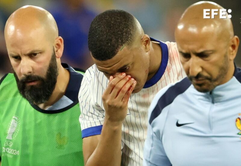 Mbappé, sin fecha de regreso: "Vamos a ver cómo evoluciona" El francés Kylian Mbappé sufre fractura de nariz, como consecuencia del golpe sufrido en un choque fortuito con Danso en el partido que enfrentó a Austria contra Francia (0-1) en el debut de ambas selecciones en el grupo D de la Eurocopa. EFE/EPA/FRIEDEMANN VOGEL